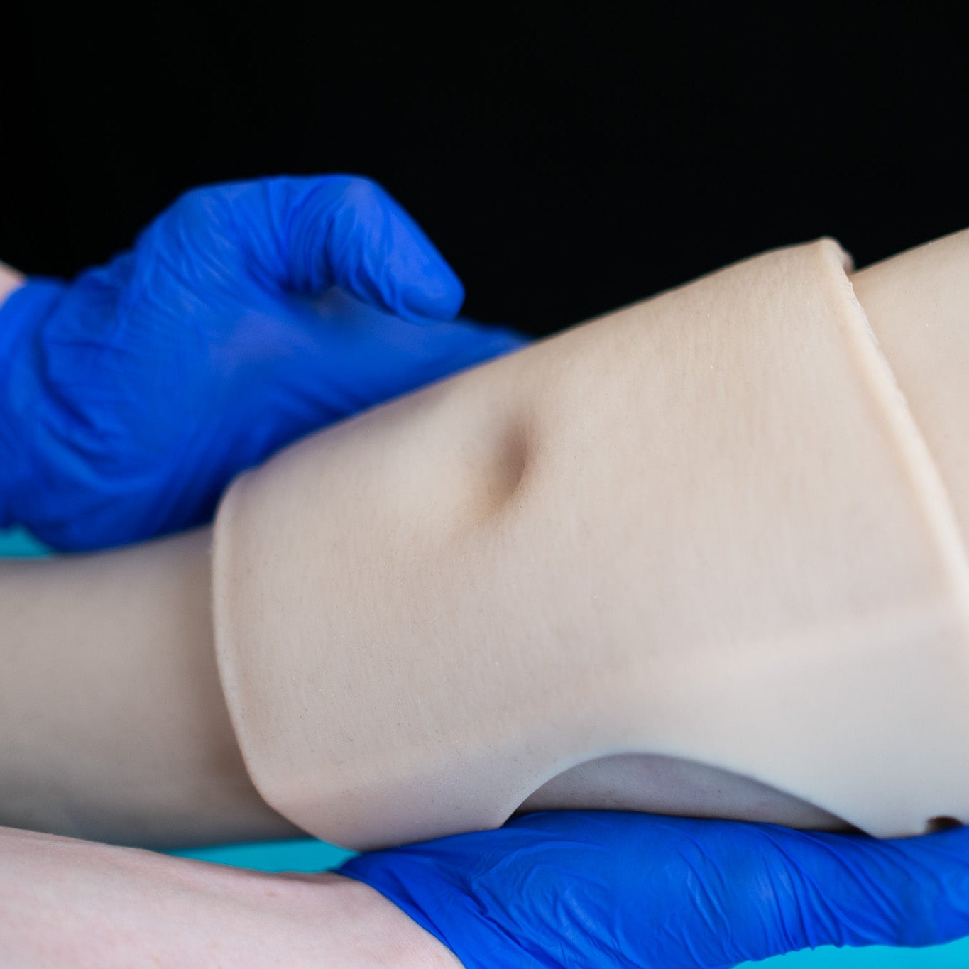 Pitting Edema